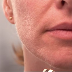 Dispozitiv pentru indepartarea parului facial Wellneo Flawless + Masca fata CADOU Dispozitiv pentru indepartarea parului facial Wellneo Flawless + Masca fata CADOU