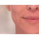 Dispozitiv pentru indepartarea parului facial Wellneo Flawless + Masca fata CADOU - Dispozitive electronice - oferit de sellsell.ro Dispozitiv pentru indepartarea parului facial Wellneo Flawless + Masca fata CADOU - Dispozitive electronice - oferit de sellsell.ro